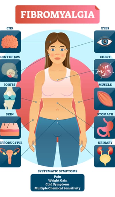 Fibromyalgia Symptoms