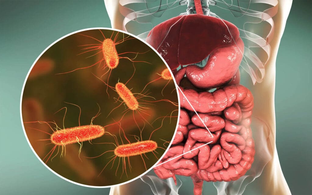 Illustration showing balanced vs. unbalanced gut microbiome linked to digestive health